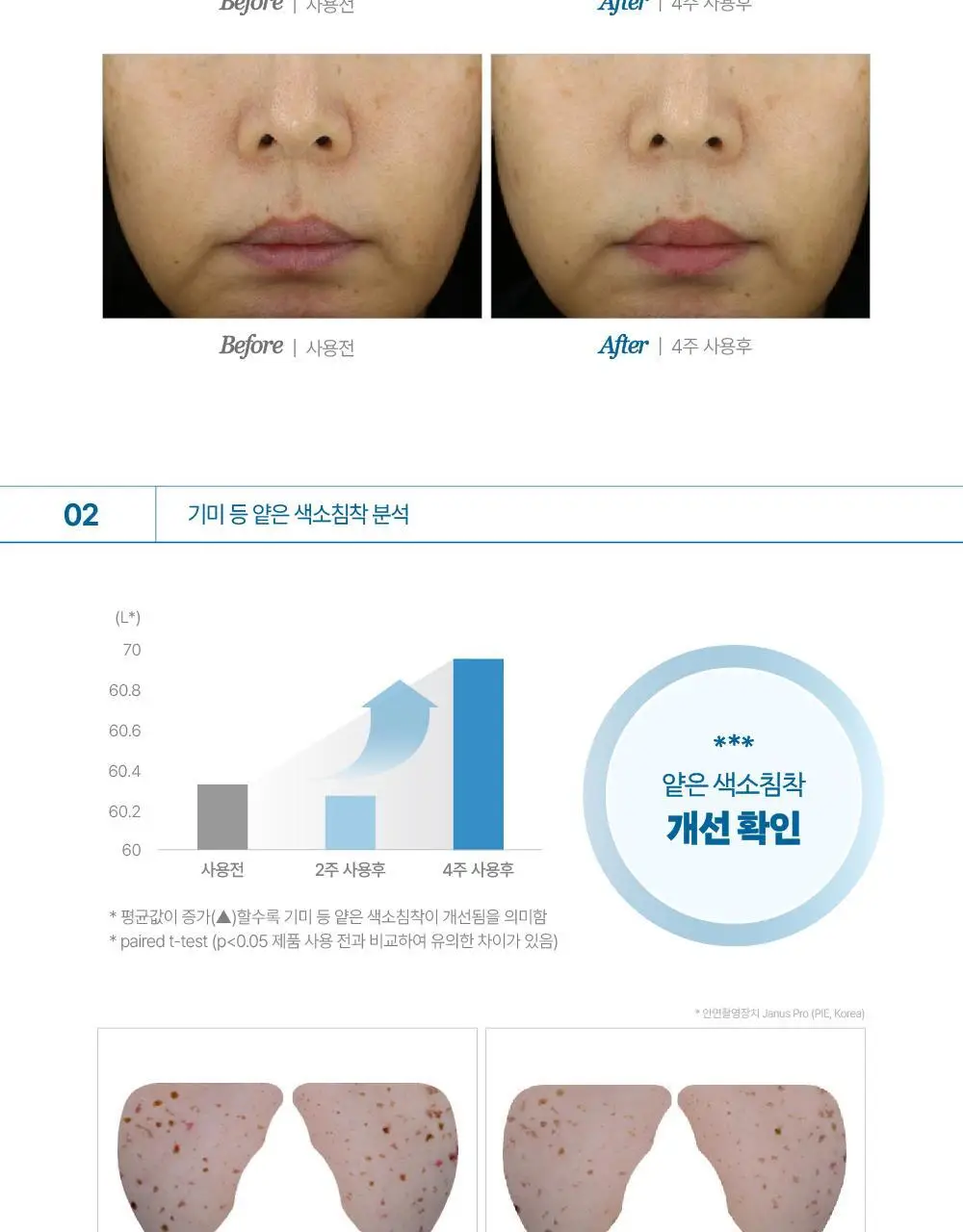 [기미패치] 라보타치 다크스팟 케어 패치 32매 상세페이지 27